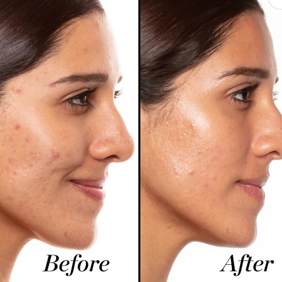 NIB Sunday Riley A+ high dose retinoid serum 1 fl oz $85 Sephora - Picture 5 of 6